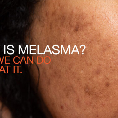 Hot Weather Essentials So You don’t Turn Into a Greaseball