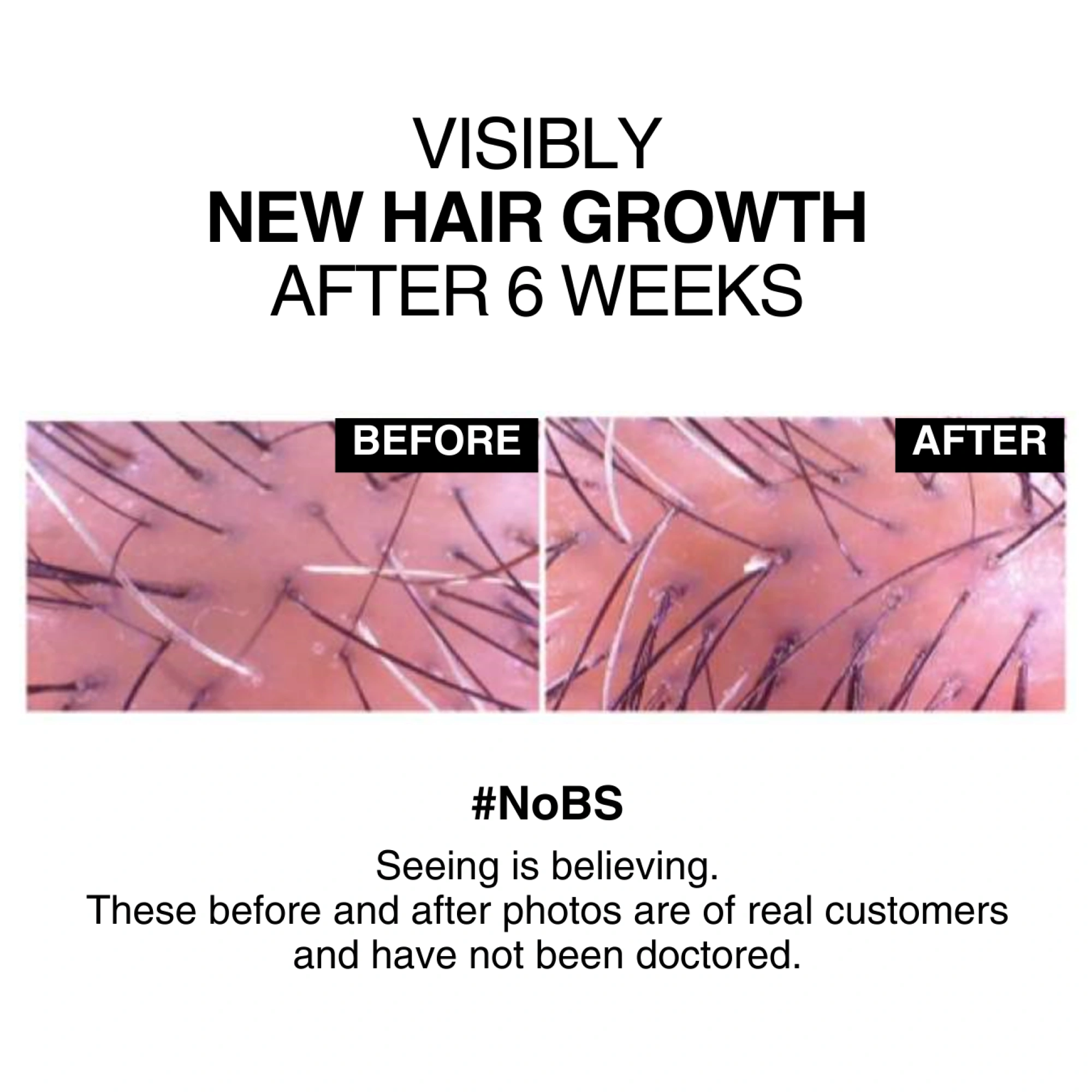 DRGL-Cleanser Hair Anti-Hairloss-After BEfore