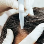 DrHair® Anti-Hairloss Scalp Treatment